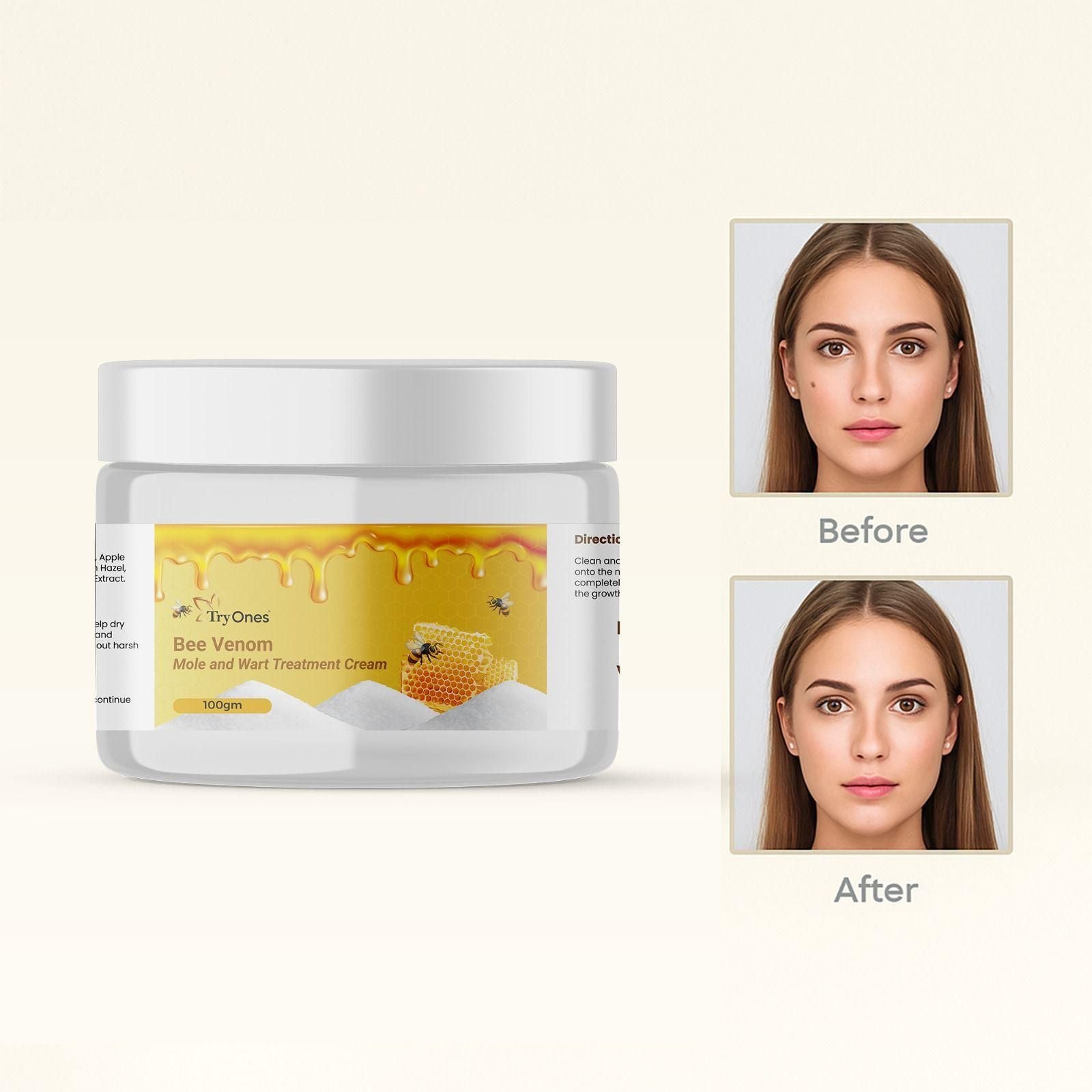 Bee Venom Mole and Wart Treatment Cream